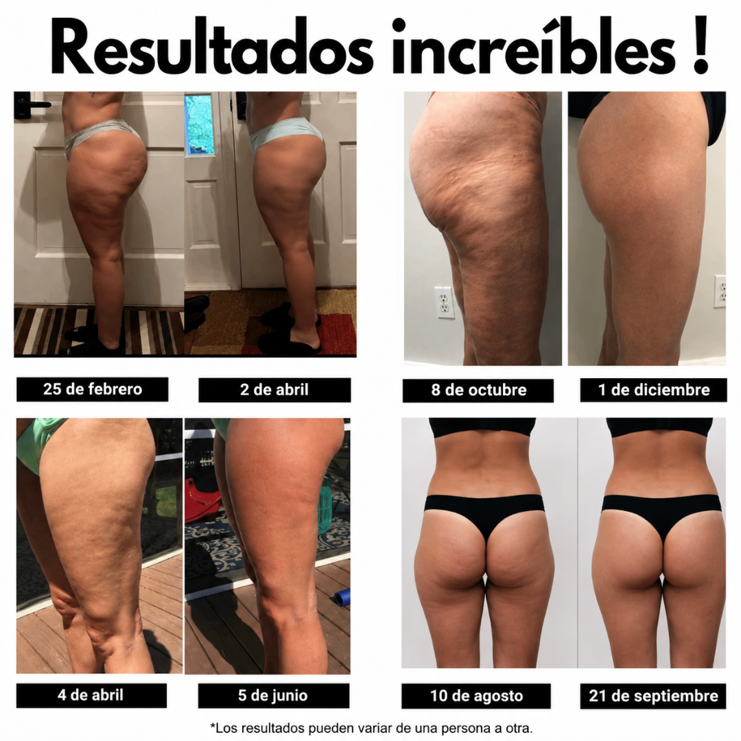 Leggings 3D Anticelulíticos y Moldeadores